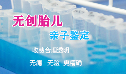 合肥父亲和肚子里胎儿如何办理亲子鉴定,合肥孕期亲子鉴定准确吗 合肥父亲和肚子里胎儿如何办理亲子鉴定,合肥孕期亲子鉴定准确吗